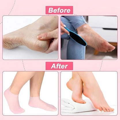 Moisturizing Silicone Gel Socks for Dry Feet Repair Deep Hydration for Cracked Skin Ultimate Foot Care Treatment for Soft & Revives Feet Overnight